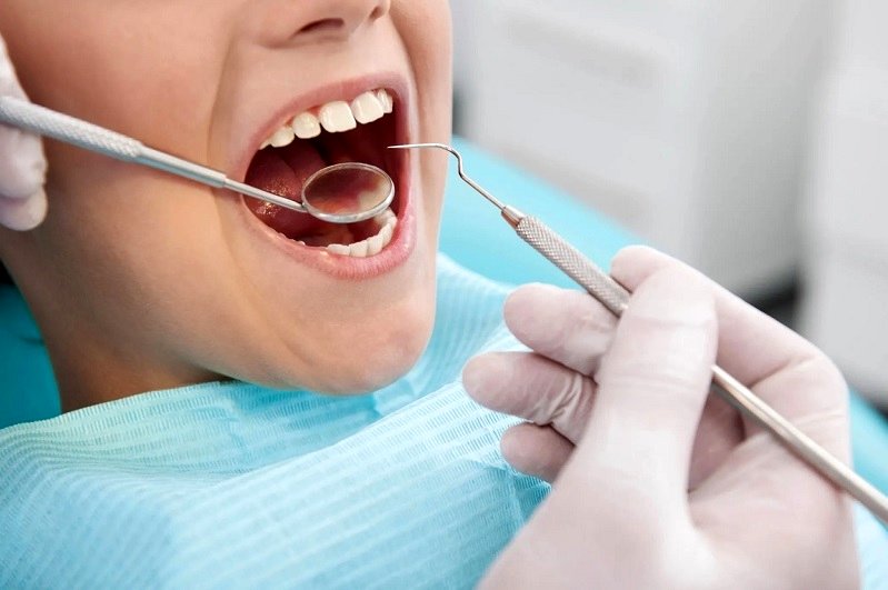 هزینه کامپوزیت دندان؛ از 1.5 تا 4.5 میلیون تومان!