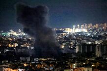 درمان مجروحان حمله رژیم صهیونیستی رایگان شد