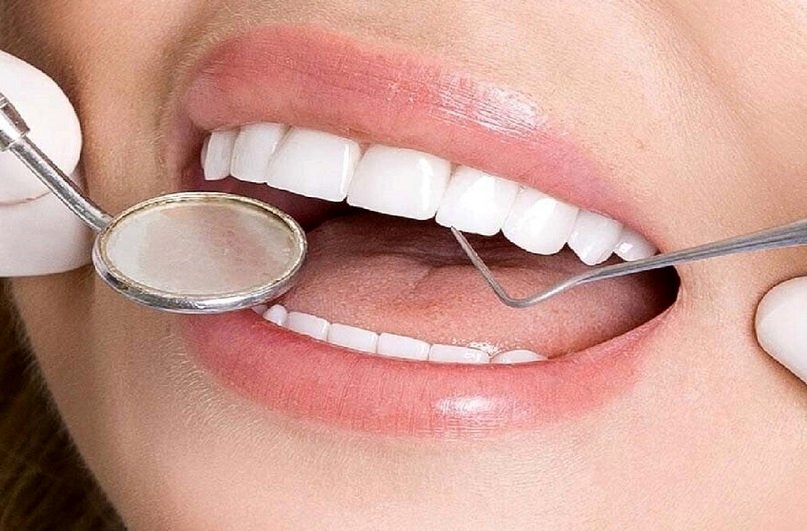 قیمت ایمپلنت دیجیتال در سال 1403 چقدر است